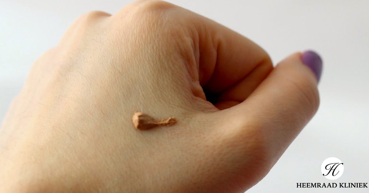 Helpt zink tegen acne?